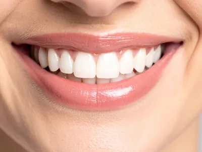 審美歯科のイメージ